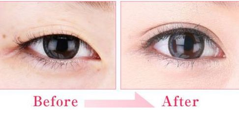 享受專業(yè)整形美容的熱門去處，廈門醫(yī)美中心等你來約