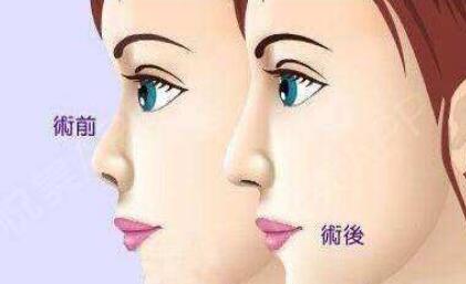 紀(jì)敏佳整容前后究竟發(fā)生了什么？