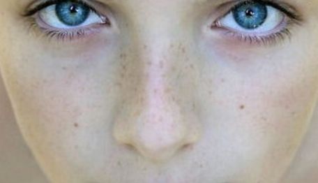 【2023年北京哪家醫(yī)院看胎痣好？專家推薦】