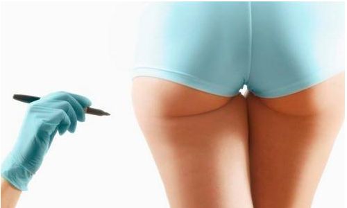 成都吸脂手術(shù)這些醫(yī)院值得你關(guān)注！五家頂尖整形醫(yī)院實(shí)力盤(pán)點(diǎn)