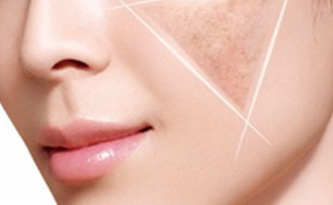 上海注射瘦臉針哪家醫(yī)院技術最專業(yè)？