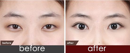 貴州靜態(tài)紋脂肪填充整形醫(yī)院哪些正規(guī)可靠？2023貴州靜態(tài)紋脂肪填充排行榜前10醫(yī)院綜合評(píng)比！