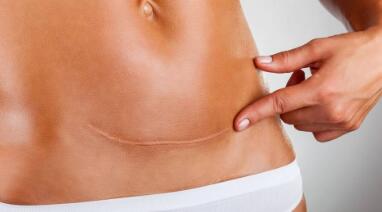 下頜磨骨手術(shù)的價格是多少？手術(shù)效果能持續(xù)多久？