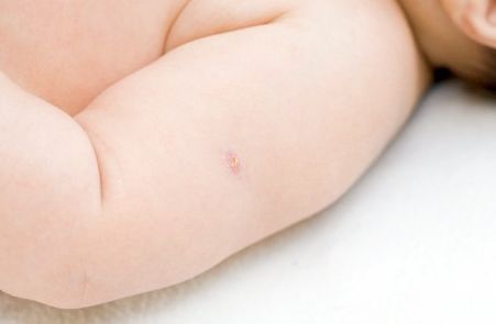 貴陽鼻子整形哪家醫(yī)院好？選擇合適的整形醫(yī)院才能安心整形！