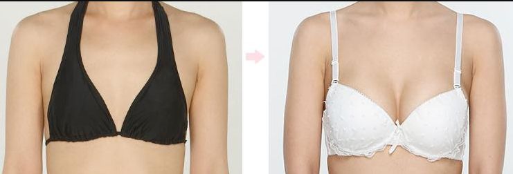 【2023上海哪家醫(yī)院去除巴好？全面解析上海頂尖去除巴醫(yī)療機構(gòu)】