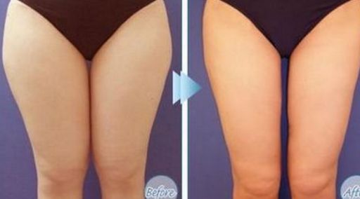 武漢雙眼皮手術(shù)醫(yī)院哪家好？綜合評(píng)價(jià)與價(jià)格公開(kāi)！