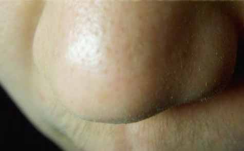 2023邯鄲重度鼻翼缺損修復：哪些整形醫(yī)院口碑居前10位？預覽比較好的醫(yī)療整形機構(gòu)！