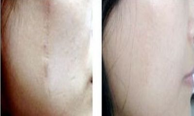 鄧琳整容了嗎？揭秘鄧琳的變化之謎