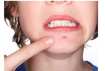 長(zhǎng)春知名整形醫(yī)院，引領(lǐng)潮流技術(shù)受追捧