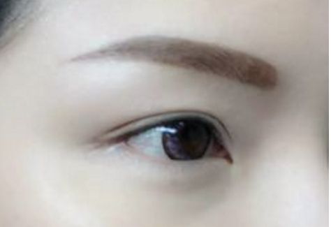 南充私立整形醫(yī)院2023年全面揭秘，錯過可惜！