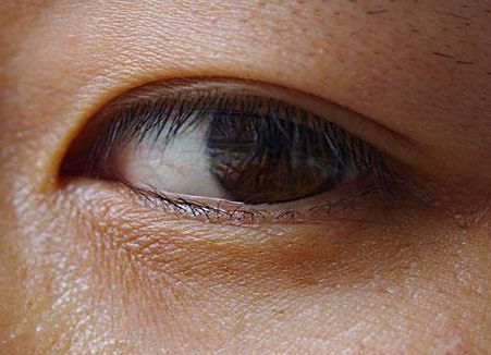 鄭元暢整容了嗎？揭秘明星整容風(fēng)潮中的真相！