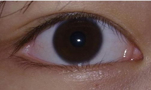 廣州拉皮手術(shù)醫(yī)生風(fēng)采揭曉，專家技藝強勁巡演，黃廣香、鄧正軍等震撼登場！