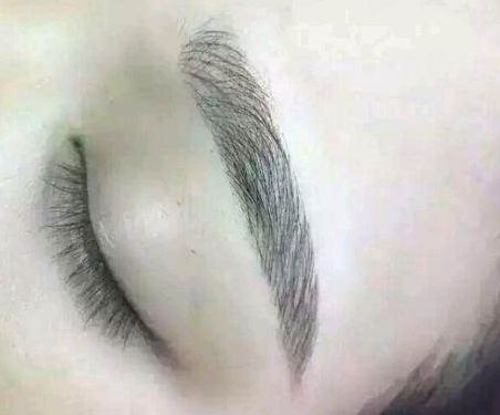 ?？谟心男I(yè)治療疤痕的醫(yī)院？?？诳窗毯坩t(yī)院哪家效果最好？