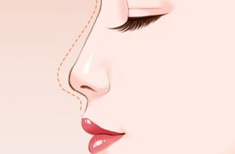 蘇州專業(yè)眉間紋改善整形美容醫(yī)院推薦，美麗煥顏新選擇