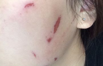 南昌哪家醫(yī)院能夠最佳完成鼻子整形手術(shù)？選擇集結(jié)，8所醫(yī)院聚焦技術(shù)與風(fēng)格展現(xiàn)！