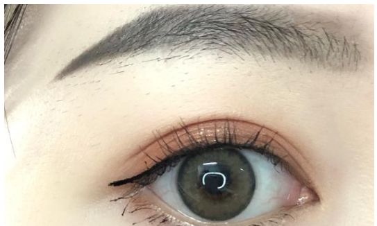 推薦：深圳有哪些值得信賴的整容醫(yī)院？名氣大，口碑好！