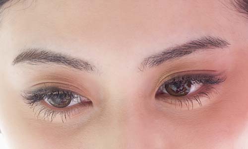 2023年眼周紋注射填充武漢哪家醫(yī)院好？TOP10整形美容醫(yī)院技術(shù)解析！