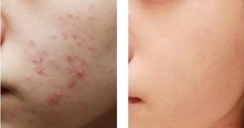 赤木晴子如何展現(xiàn)自己的獨(dú)特魅力？