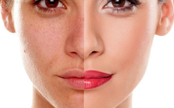 福州韓式整容醫(yī)院哪家好？探尋福州市備受好評的韓國整容醫(yī)院！