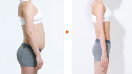 鄭爽整容復(fù)原了嗎？揭秘鄭爽整容傳聞的真相