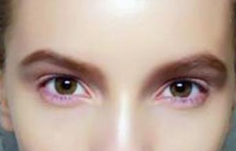 李沁整容前后變化是事實(shí)嗎？明星整容有哪些影響？