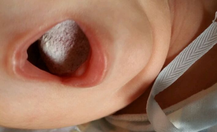 天津陰唇整形醫(yī)院哪家好？揭秘天津地區(qū)專業(yè)陰唇整形醫(yī)院排行榜！