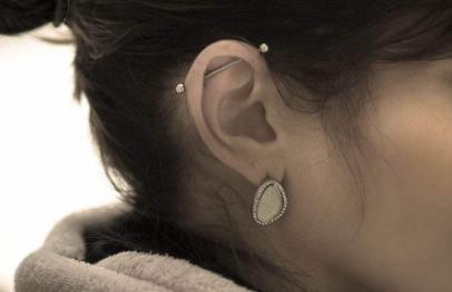 臉部拉皮手術(shù)價格究竟如何？關(guān)鍵因素都有哪些呢？