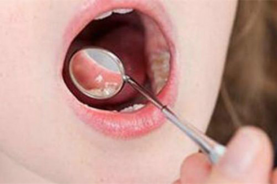 合肥哪家醫(yī)院去胎記效果好？有哪家醫(yī)院做去胎記比較專業(yè)？