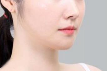 磨腮削骨后的副作用有哪些？如何減少副作用的風(fēng)險(xiǎn)？