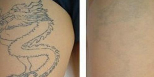 郭敬明是否通過整容改變了形象？