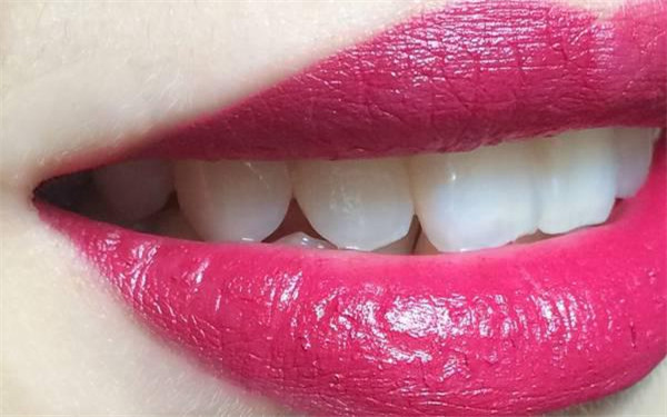 廣州哪家整形美容醫(yī)院做鼻子墊假體手術(shù)好？2023年美容醫(yī)院TOP10評(píng)分超高，技術(shù)流派強(qiáng)勢(shì)！