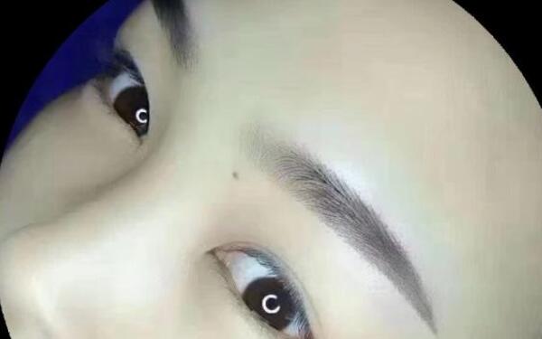 牙齦腫痛吃藥有什么好方法？這些急救措施值得收藏！