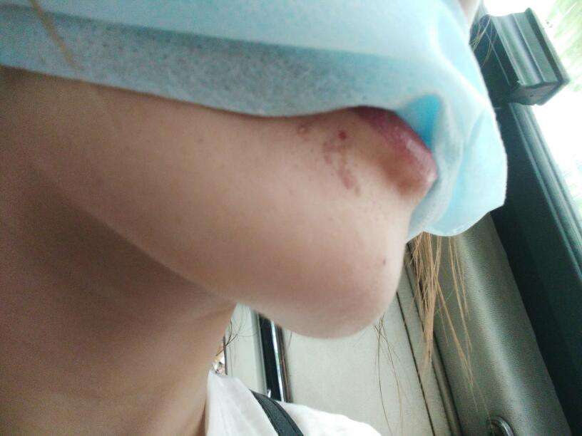 上海美希卓馨醫(yī)療美容醫(yī)院技術(shù)如何？整形效果靠譜嗎？