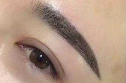 金卡戴珊整容了嗎？揭秘她美貌背后的秘密！