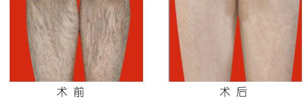 如何去除眼袋？學(xué)習(xí)有效小技巧，說再見煩惱