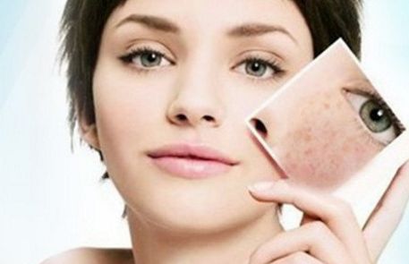 昆明去痘坑哪家醫(yī)院專業(yè)好？