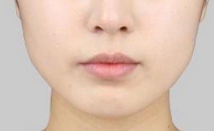 2023深圳吸脂塑身醫(yī)院排行榜前十強(qiáng)，哪家技術(shù)比較靠譜？