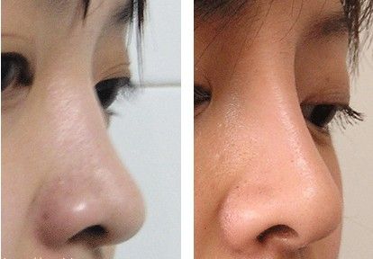 上海哪家醫(yī)院黑眼圈效果好？排名最好的專業(yè)醫(yī)院有哪些？