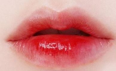 武漢去痘坑醫(yī)院哪家好？揭秘武漢最受歡迎的去痘坑醫(yī)院排行榜！