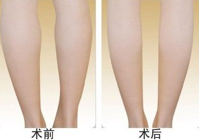 天津優(yōu)質(zhì)整容醫(yī)院-高超技術(shù)解決面部抗皺困擾