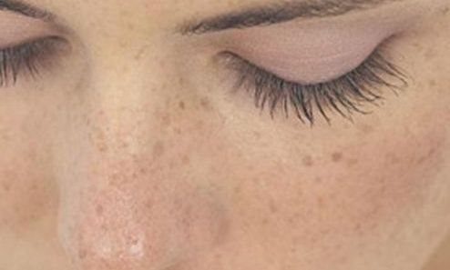 全國哪家醫(yī)院的偏頜整形效果好？如何選擇最適合自己的醫(yī)院呢？