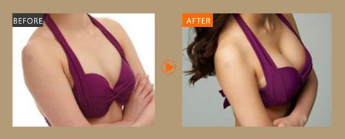 2023成都比較靠譜的激光祛除眼底紋醫(yī)療美容醫(yī)院推薦！排名榜前十等你來選擇！