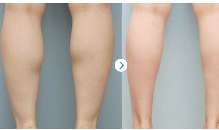 2023大連鼻部改善最佳醫(yī)療機(jī)構(gòu)闡述