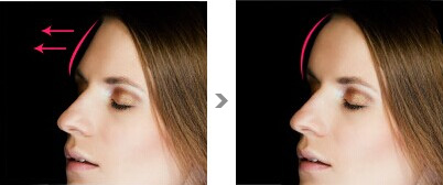 2023年沈陽(yáng)哪家醫(yī)院做面部除皺整形比較好？沈陽(yáng)面部除皺術(shù)醫(yī)療整形醫(yī)院top10強(qiáng)排名公布！