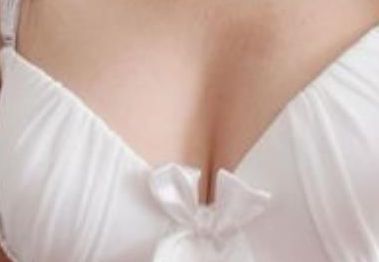 北京哪家醫(yī)院看減肥效果好？