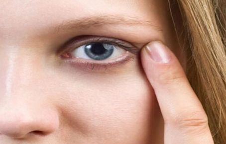 伊美康整形美容 雙眼皮效果如何？?jī)r(jià)格一覽一目了然