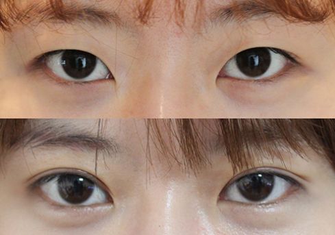 2023南京自體脂肪隆胸手術(shù)醫(yī)院排名TOP10，效果一覽無(wú)余！