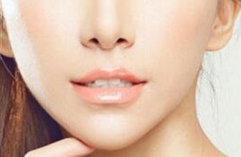 合肥哪家醫(yī)院做面部吸脂效果好且專業(yè)？