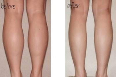 長沙哪家醫(yī)療美容整形醫(yī)院硅膠隆胸價位劃算？2023長沙硅膠隆胸整形醫(yī)療榜單前十詳細名單公布！