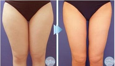 西寧整容醫(yī)院排名前八，口碑好，專業(yè)可靠的有名氣！